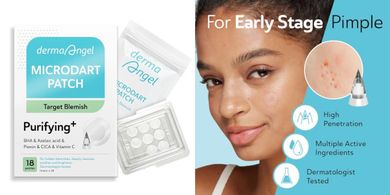 Hydrocolloid Acne Patches with Salicylic & Azelaic Acids for Stubborn Blemishes
