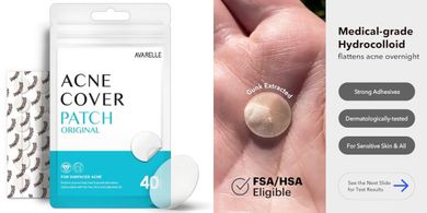 Avarelle Acne Patches: Hydrocolloid, Tea Tree Oil, Vegan, FSA/HSA Eligible
